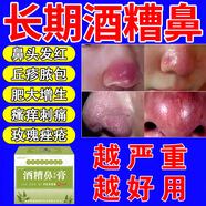 酒糟鼻專用的藥膏紅鼻子真菌草莓鼻去黑頭紅腫紅血絲膿包螨蟲(chóng)粉刺 一盒【體驗(yàn)裝】