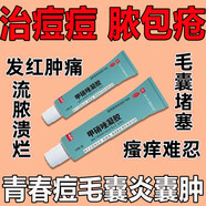 珍珠疹去除藥品男性冠狀溝珍珠疹專(zhuān)用藥丘疹?？焖偃コ匦炉熜幠腥讼麦w私處瘙癢止癢殺菌藥硝酸咪康唑乳膏 2盒裝痤瘡粉刺青春痘 囊腫炎癥