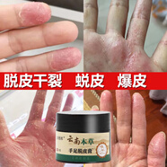 云南本草手足脫皮抑菌膏季節性手脫皮手指頭手掌蛻皮干裂起皮爆皮真菌感染 【手足脫皮膏30g】一瓶裝 1瓶/盒