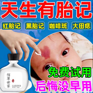 胎記去除膏神器去胎記臉部黑色素太田咖啡斑淡化老年黃褐雀斑紅胎記遺傳胎記全身胎記祛除膏 單盒裝
