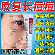 川石止癢長(cháng)痘藥膏痘印修復淡化痘印痘坑修復藥膏滿(mǎn)臉痘學(xué)生青春痘改善粉刺閉口紅霉素軟膏 1盒【otc國藥準字 24小時(shí)發(fā)貨】臉上起粉刺