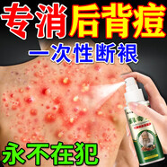 洛神雪后背祛痘毛囊炎進(jìn)口藥去背上長(zhǎng)痘痘和痘印發(fā)癢背部祛痘藥膏噴霧劑 【99%的選擇】當(dāng)晚祛痘 30ml 3瓶 前胸后背祛痘毛囊炎噴霧劑一噴消