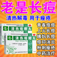 臉上去痘痘的藥】解毒痤瘡清熱暗瘡?fù)? 清熱解毒祛痘痘粉刺和痘印臉上起紅疙瘩內(nèi)分泌失調(diào)痘痘內(nèi)調(diào)中藥口服 3盒【男女學(xué)生成人臉上反復(fù)長痘痘】