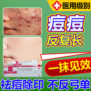 阿達帕林凝膠醫用祛痘消炎痤瘡專(zhuān)用藥祛痘藥膏臉上去痘痘和痘印青春痘粉刺痤瘡特有效藥抗痘凝膠皮膚用藥 5盒【頑固痘痘消不掉 反復長(cháng)】一次買(mǎi)對 告別痘痘