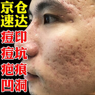 內(nèi)廷上用祛痘印去痘坑去痘疤痘印痘坑修護復凹洞黑色素沉淀淡化 一盒體驗裝【拍二發(fā)三】