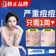 修正祛痘膏修復淡化痘印痘坑控油男女護膚品學生青春痘去痘痘凝膠精華 祛痘膏1支裝【控油祛痘】