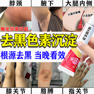 維a酸乳膏治療由角化異常引起去黑色素沉淀去除面部脖子嘴唇屁股大腿內側黑色素去除私處粉嫩淡化黑素色 3盒【去黑色素 黑棘皮】