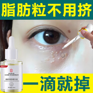 南京同仁堂脂肪粒去除神器眼部專用去眼部脂肪粒眼袋清肌顆粒眼部精華液