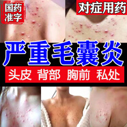 毛囊炎藥膏毛囊炎專用藥后背胸前頭皮長疙瘩膿皰痘痘膿包發(fā)癢流膿毛囊炎皮膚瘙癢膿包紅腫曲安奈德益康唑乳膏 5盒裝【一次選對 還你一個健康皮膚】告別毛囊炎