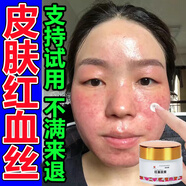 去皮膚紅血絲修復(fù)角質(zhì)層薄敏感肌修復(fù)面部泛紅復(fù)去除紅皮膚血絲高原紅修復(fù)面霜水乳 買二發(fā)三【只需兩盒價(jià)】