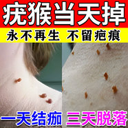 疣瘊靈去除脖子小肉粒去·肉粒疙瘩神器祛疣膏去肉粒猴子去肉維a酸乳膏 1盒【水楊酸皮膚用藥去雞眼疣靈面部脖子圖視覺(jué)特效