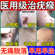 維a酸乳膏去疣醫(yī)用去疣膏 扁平疣專用藥猴子扁平疣面部專用藥脖子瘊子肉刺肉粒疙瘩專用軟膏 皮膚用藥 2盒【扁平疣 瘊子小肉粒專用藥膏】