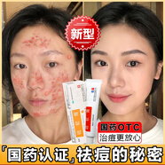 硫軟膏 臉上長(zhǎng)痘痘專用藥青春期祛痘看印修復(fù)淡化看痘印痘坑修復(fù)藥膏去痘痘和痘印女孩祛痘藥膏學(xué)生醫(yī)用的藥 1支治痘痘乳膏（紅霉素）