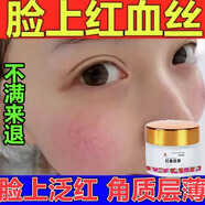 去皮膚紅血絲修復(fù)角質(zhì)層薄敏感肌修復(fù)面部泛紅復(fù)去除紅皮膚血絲高原紅修復(fù)面霜水乳 買三發(fā)五【只需三盒價(jià)】
