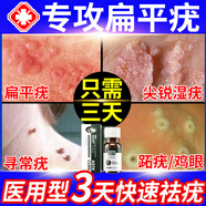 ASTACURE疣體脫落膏去疣膏旗艦店醫用快速去疣體100%特效藥克點(diǎn)痣點(diǎn)疣藥水