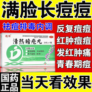 清熱解毒痤瘡瘡丸去火祛痘排毒臉上去痘痘的藥治祛痘膿皰瘡下巴紅腫硬去痘痘和痘印內(nèi)分泌失調(diào)男女清熱暗瘡丸 1盒【臉上長痘痘】建議療程裝