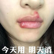 云南本草唇愈膏嘴唇干裂脫皮起泡嘴角保濕潤唇膏男女通用20g支1盒 三盒60g鞏固裝
