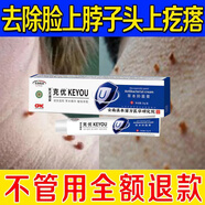 克優(yōu)膏尖銳濕尤脖子肉粒腋下絲狀憂尤肉疙瘩皮贅扁平尤尤尋常尤 1盒裝