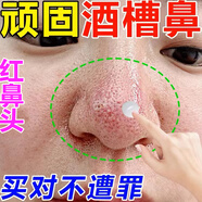 酒糟鼻專用非藥修復草莓鼻紅鼻子紅血絲酒渣鼻螨蟲痤瘡鼻翼兩側泛紅鼻頭粉刺黑頭毛孔粗大脂溢性皮炎軟膏 買二送一【支持試用】發(fā)3盒