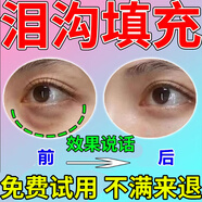 淚溝填充神器填充修復(fù)法令紋淚溝眼窩凹陷臉去除黑眼圈魚(yú)尾紋精華油 單盒裝