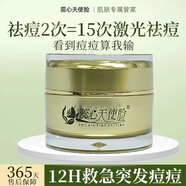 蕊心天使臉草本祛痘膏淡化痘印閉口粉刺痤瘡去痘修復(fù)霜男女學(xué)生青春痘護膚品 草本祛痘霜【送洗發(fā)水體驗裝*1】