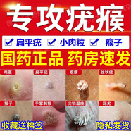 維a酸乳膏 扁平疣藥膏 去猴子扁扁平疣專用藥去疣體專用藥猴子去除藥膏肉刺肉粒治療多種疣皮膚用藥 1盒裝 對癥用藥為您解“疣”國藥準(zhǔn)字 藥房速發(fā) 穗玉芊大藥房承諾：所有規(guī)格均送棉簽 祝您早日康復(fù)