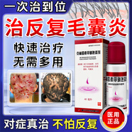 天龍毛囊炎頭部專用藥頭皮癢止癢頭皮起膿包疙瘩藥膏真菌感染脂溢性皮炎皮膚用藥克林霉素甲硝唑搽劑【視覺特效】 1盒裝【毛囊炎專用】