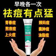 香港東南亞大藥房祛痘膏淡化痘印痘坑修復改善粉刺閉口去痘痘痘印 五盒強效裝 香港東南亞草本祛痘膏20g一盒
