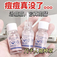 北京同仁堂【官方正品】祛痘精華液淡化痘印閉口粉刺毛孔粗大收縮毛孔黑頭雙 5瓶重度痘肌 50ml