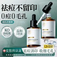 儒意（RUYI）水楊酸精華液果酸收縮毛孔粗大可搭祛痘修復淡化痘印痘坑清理閉口