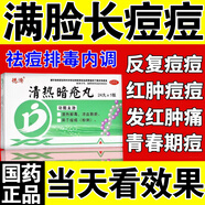 清熱解毒痤瘡瘡?fù)枞セ痨疃慌哦灸樕先ザ欢坏乃幹戊疃荒摪挴徬掳图t腫硬去痘痘和痘印內(nèi)分泌失調(diào)男女清熱暗瘡?fù)?1盒【臉上長痘痘】建議療程裝
