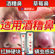 示博士酒糟鼻草莓鼻紅腫玫瑰痤瘡紅鼻子專用去粉刺黑頭紅血絲螨蟲(chóng)修護(hù)軟 一盒初期裝（輕微型） 搭紅鼻子酒糟鼻頭紅腫消炎產(chǎn)品用
