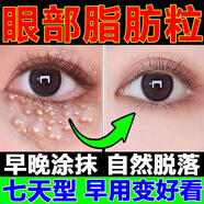 汗管瘤脂肪粒眼部專用去除膏可搭去除神器顆粒清肌精華液眼部汗管粒油脂粒男女通用 （第二盒半價）優(yōu)惠組合