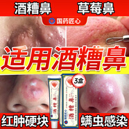 示博士酒糟鼻草莓鼻紅腫玫瑰痤瘡紅鼻子專用去粉刺黑頭紅血絲螨蟲(chóng)修護(hù)軟 三盒周期裝（中度型） 搭紅鼻子酒糟鼻頭紅腫消炎產(chǎn)品用