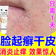 三順 臉干燥起皮瘙癢止癢潤膚秋冬臉粗糙嘴角開(kāi)裂干裂起皮口角炎藥膏男女過(guò)敏脂溢性皮炎參皇軟膏 5盒【皮膚太干巴】滋潤皮膚