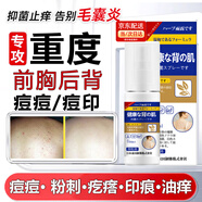 后背祛痘背后長痘痘藥膏背部毛囊炎前胸噴劑專用痘印身上洗背瘙癢 1盒裝【一噴祛除】特效噴劑
