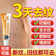 ASTACURE進(jìn)口防妊娠紋油孕期妊娠紋修復霜預防孕婦專(zhuān)用淡化肥胖紋生長(cháng)紋油