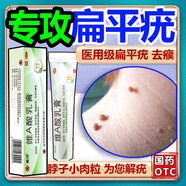 維A酸乳膏去疣體特新效期藥扁平疣專用藥去疣類藥膏去脖子小肉粒頸部瘊子去尤瘊小肉粒去疣膏瘊子肉刺肉粒 1盒裝【國藥準(zhǔn)字脫疣瘊】 瘊子去除國藥準(zhǔn)字藥膏  放心購買 安心售后