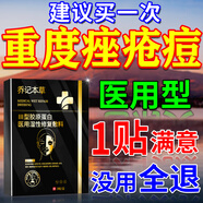 北京同仁堂痤瘡專(zhuān)用膏玫瑰痤瘡粉刺硬消炎蘆薈膠保濕補水淡斑祛痘印收縮毛孔 一盒面膜【可搭配使用】(發(fā)貨特效快) 祛痘印精華液淡化痘印痘坑痘疤修復醫用痤瘡涂膜劑