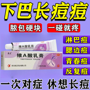 下巴紅腫硬痘痘淋巴痘腮邊痘硬塊祛痘內(nèi)分泌失調(diào)毛孔粗大下巴閉口粉刺祛痘痤瘡皮膚用藥 非處方藥維A酸乳膏 1盒【下巴爆痘紅腫疙瘩膿包痤瘡】買對(duì)才管用
