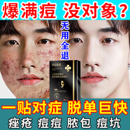 樂(lè )修祛痘消炎痤瘡專(zhuān)用青少年青春痘粉刺痤瘡硬疙瘩專(zhuān)用非藥去除痘印坑 面膜*買(mǎi)3送2【重度痤瘡流膿包】無(wú)用退全款 痘痘修復消炎痘印痘坑面膜祛痘印控油祛痘淡化痘印