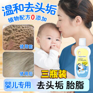 嬰兒油潤滑劑去黑頭乳痂新生兒軟化頭皮垢寶寶胎脂專用撫觸油 3瓶裝【成分自然安全】囤貨 官方直售