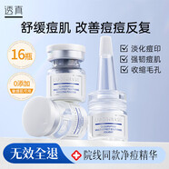 透真寡肽凍干粉精華液16瓶（舒緩祛痘 敏肌可用 提亮淡化痘印原液）