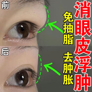 腫泡眼去脂消腫眼部干眼霜脂肪厚紅腫水腫上眼皮松弛大眼袋專(zhuān)用貼 3盒【兩盒價(jià)格】免費試用一盒