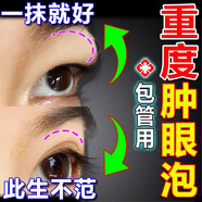 腫泡眼去脂消腫眼部干眼霜脂肪厚紅腫水腫上眼皮松弛大眼袋專(zhuān)用貼 單盒【腫眼泡專(zhuān)用】調整裝