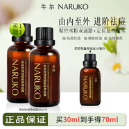 牛爾茶樹(shù)控油祛痘粉刺凈膚露去角質(zhì)精華水楊酸爐甘石黑頭護(hù)膚開(kāi)學(xué)季 【活動(dòng)劃算】粉刺凈膚露到手70ml
