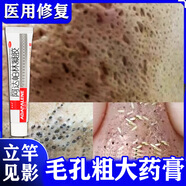 阿達(dá)帕林醫(yī)用凝膠祛痘消炎痤瘡專用改善毛孔粗大收縮毛孔去黑頭修復(fù)細(xì)致水楊酸軟膏角質(zhì)增生皮膚暗沉干燥 5盒啊阿達(dá)帕林【告別毛孔粗大】重回容顏?zhàn)孕?
                                         title=