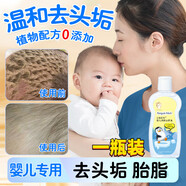 嬰兒油潤滑劑去黑頭乳痂新生兒軟化頭皮垢寶寶胎脂專用撫觸油 1瓶裝【撫觸去頭垢】 官方直售