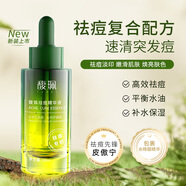 馥珮祛痘精華液淡化痘印男女水楊酸皮傲寧煥亮補水保濕小綠瓶官方正品 突發(fā)痘、熬夜痘人群推薦 30ml