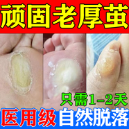 去腳底老繭去硬皮 老繭軟化膏繭子去除去老繭去腳底老繭去硬皮雞眼膏 去根肉刺藥膏無痛脫落水楊酸軟膏 兩盒【軟化角質 去死皮】早用不受罪